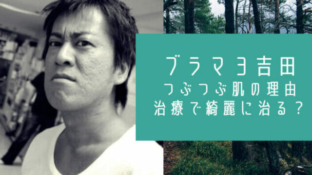 ブラックマヨネーズ吉田の肌の原因はニキビ潰し 実は治療で綺麗に治る お笑い芸能headline