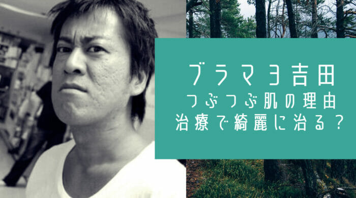 ブラックマヨネーズ吉田の肌の原因はニキビ潰し 実は治療で綺麗に治る お笑い芸能headline ブラックマヨネーズ吉田の肌の原因はニキビ潰し 実は治療で綺麗に治る お笑い芸能headline