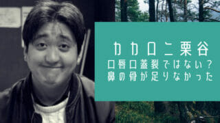 カカロニ栗谷と口唇口蓋裂